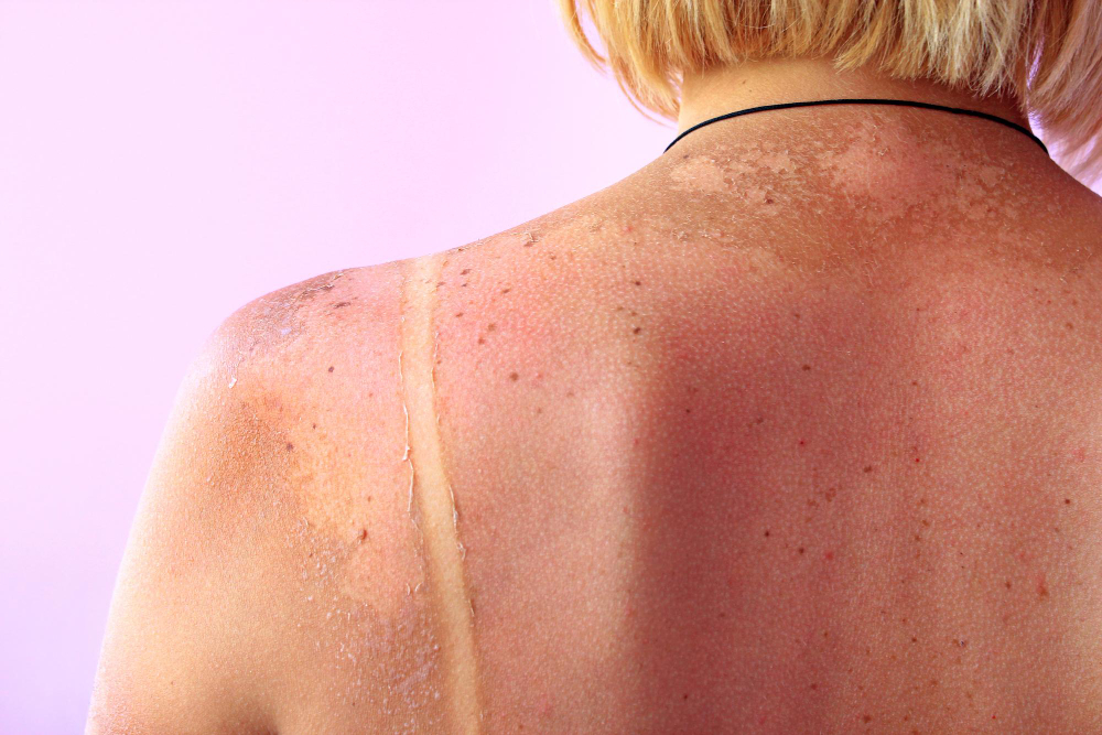 What Causes Rough Skin Texture? Treatments That Actually Work
