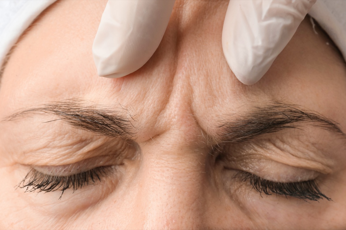 forehead-wrinkles-being-examined-for-skincare-trea-2026-03-18-13-34-41-utc