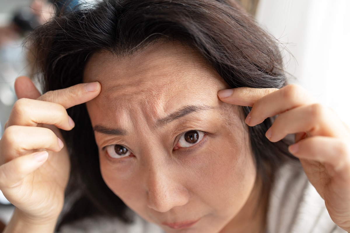 woman-inspecting-her-forehead-skin-with-fingers-2026-03-27-02-09-43-utc